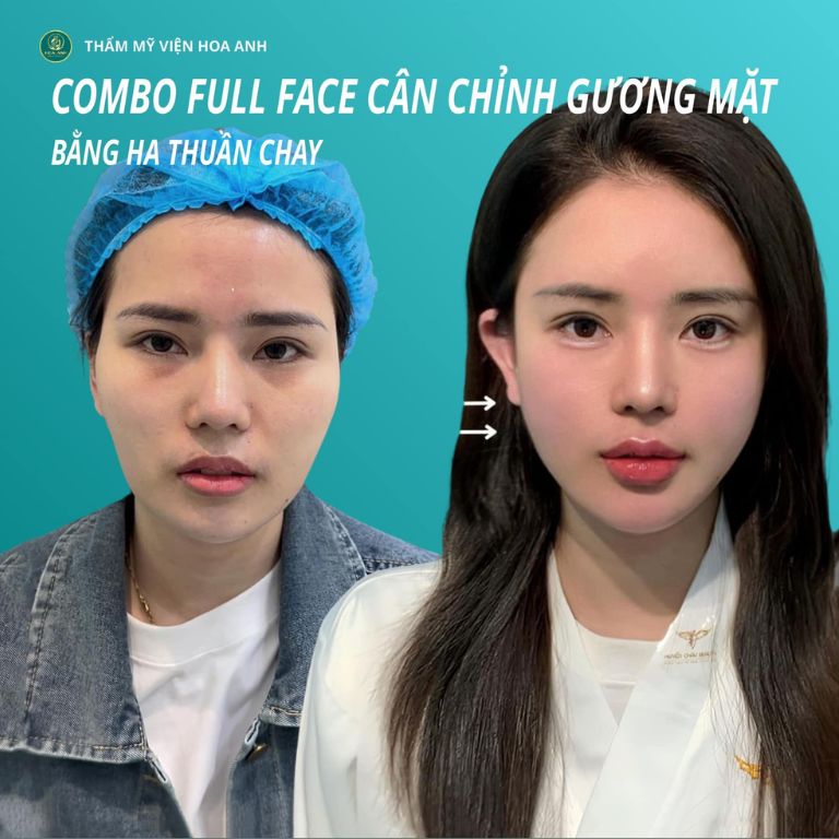 Thẩm Mỹ Viện Hoa Anh