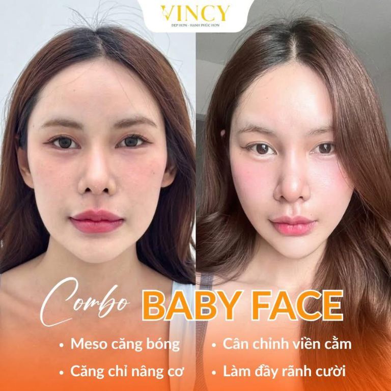 Viện Thẩm Mỹ VINCY