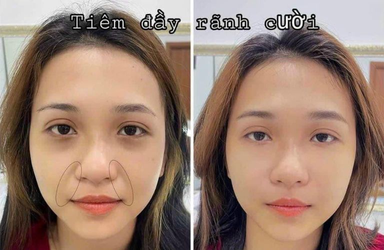 Thẩm Mỹ Quốc Tế EMIA