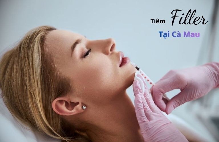 Địa chỉ tiêm filler tại Cà Mau uy tín, an toàn