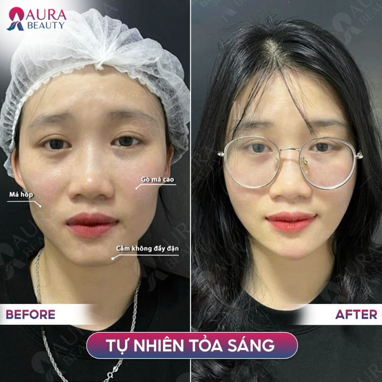 Thẩm Mỹ Viện Quốc Tế Aura