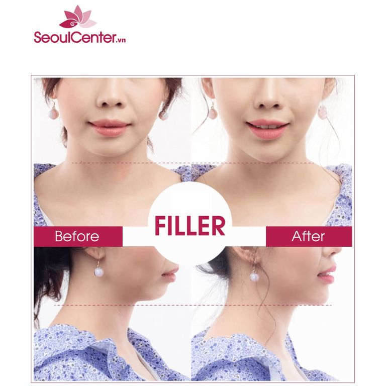 Thẩm mỹ viện Seoul Center