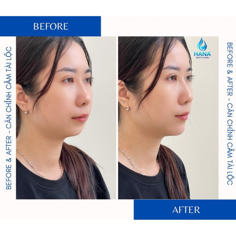 Spa Hana Beauty & Clinic