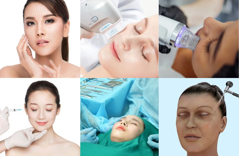 Các phương pháp căng da mặt xoá nhăn hiệu quả