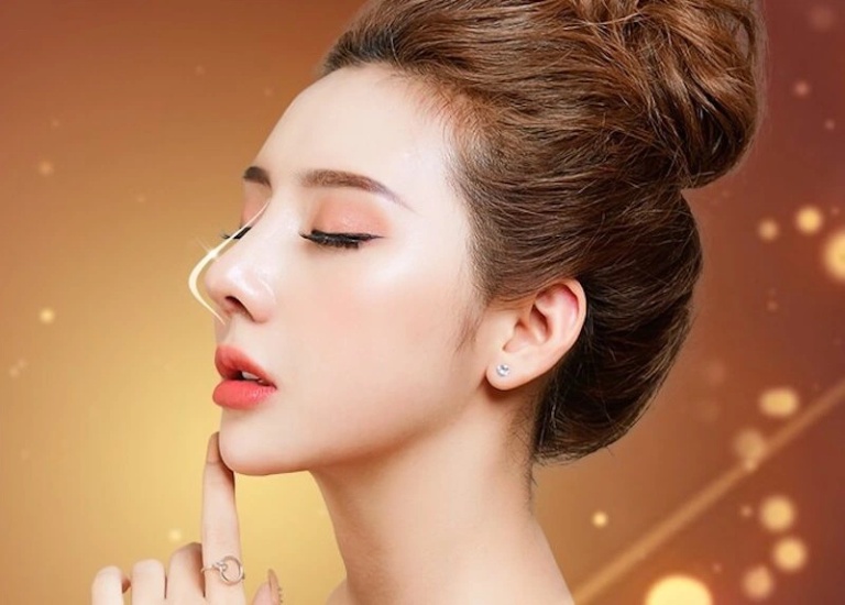 đối tượng nâng mũi bọc sụn tự thân