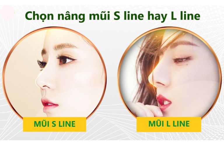 Nâng mũi L Line và S Line