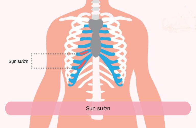 Quá trình phẫu thuật phức tạp và đau đớn hơn vì cần phải lấy sụn từ vùng sườn
