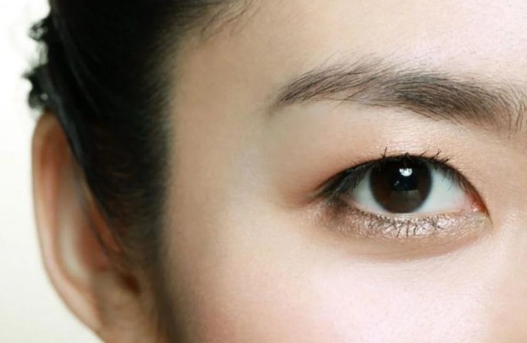 Phương pháp cắt mí mắt phù hợp với những người có mắt một mí