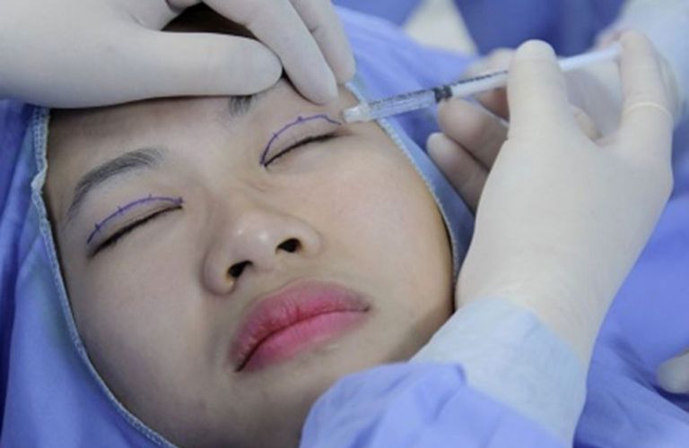 Cắt mí mắt thường không gây đau đớn nhờ gây tê tại chỗ trước khi phẫu thuật