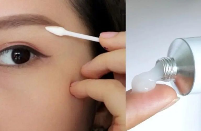 Bôi thuốc mỡ phục hồi theo chỉ định của kỹ thuật viên