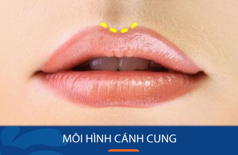 Môi cánh cung
