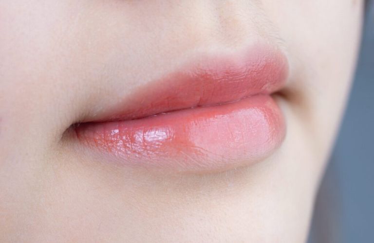 Môi mỏng tự nhiên