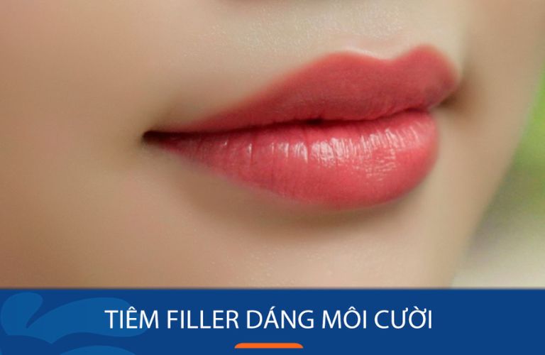 Môi cười