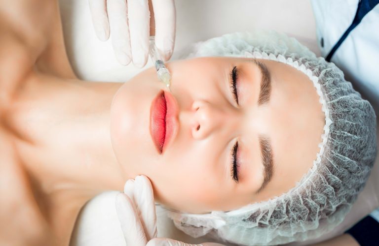 Tiêm Filler môi bao lâu hết sưng
