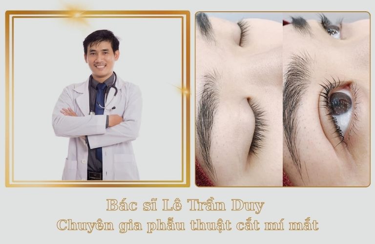 Cắt mí mắt đẹp và an toàn cùng với chuyên gia thẩm mỹ Lê Trần Duy