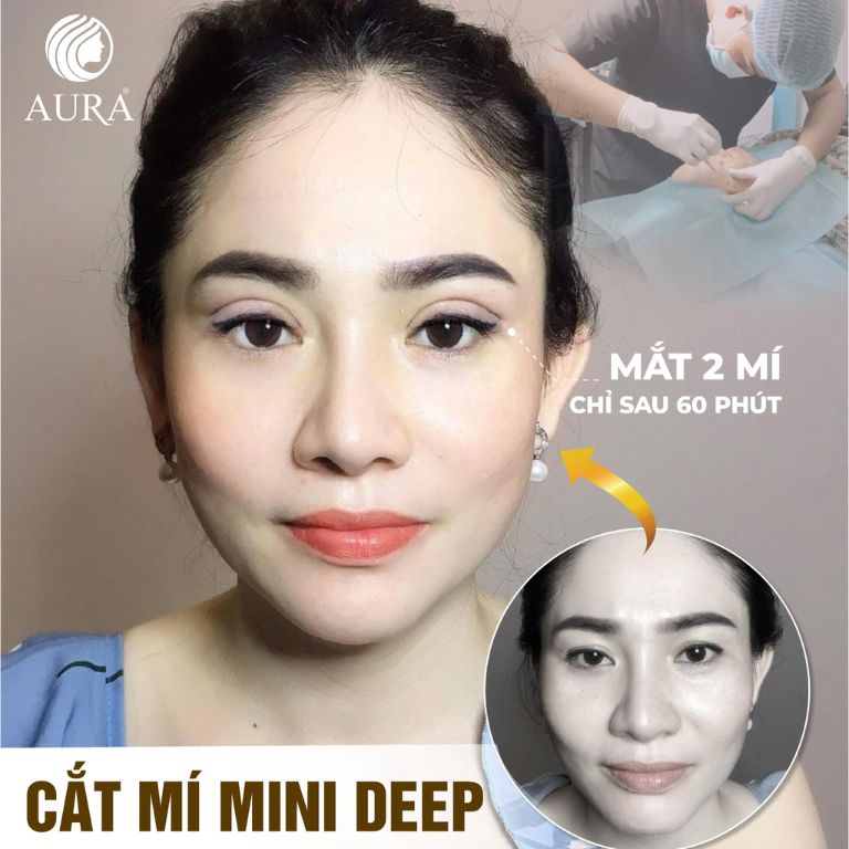 Thẩm mỹ viện quốc tế Aura luôn chú trọng đến kỹ thuật và dịch vụ chăm sóc khách hàng
