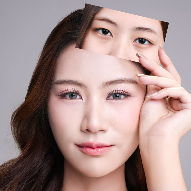 Chọn bác sĩ cắt mí có chuyên môn cao và nhiều năm kinh nghiệm, đảm bảo mí đẹp hoàn hảo