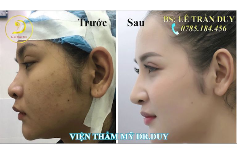 Cách đăng ký chương trình