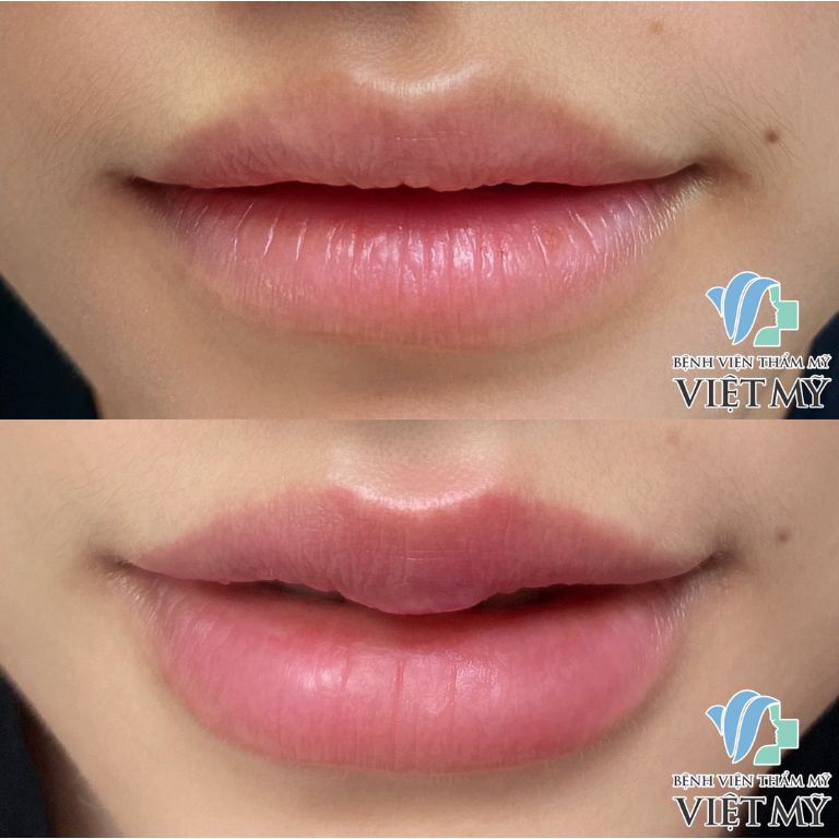 Bệnh viện thẩm mỹ Việt Mỹ