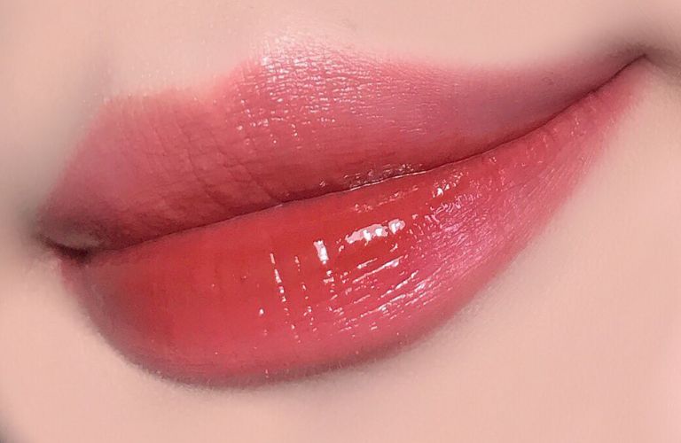 10 Địa chỉ cấy môi sinh học ở TPHCM an toàn, thẩm mỹ