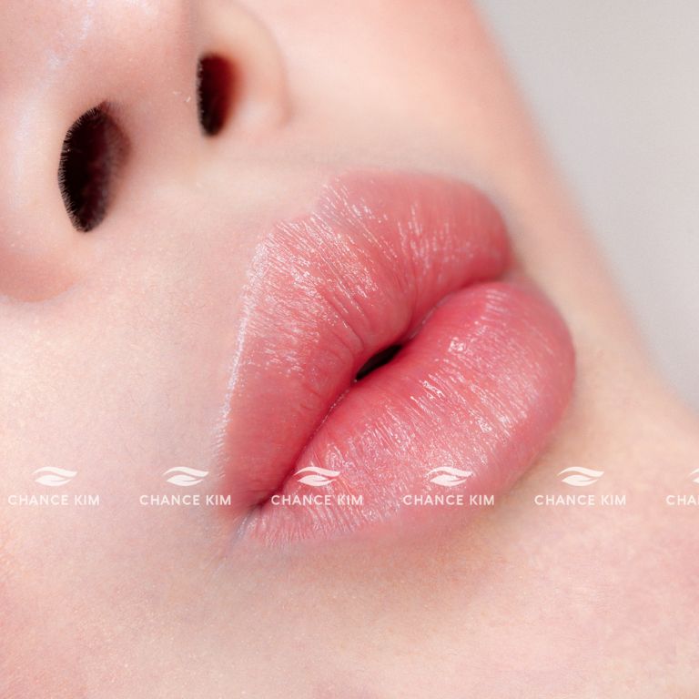 Thẩm mỹ viện Chance Kim