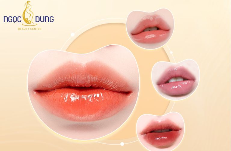 Thẩm mỹ viện Ngọc Dung