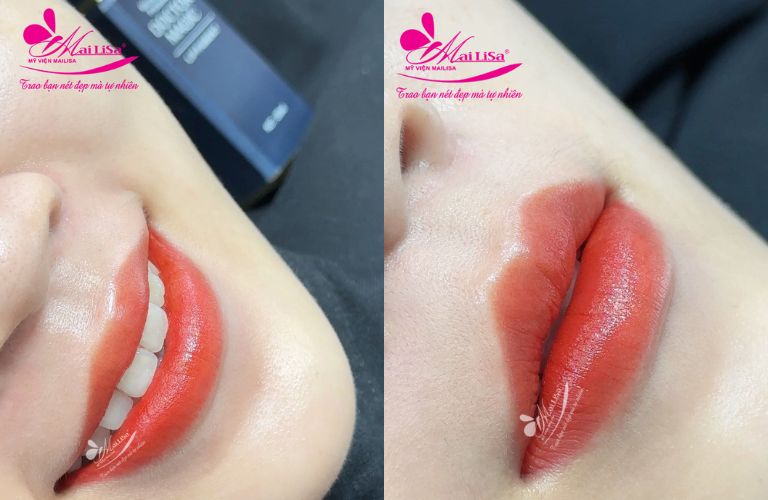 Thẩm mỹ viện Mailisa