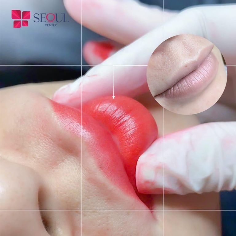 Thẩm mỹ viện Seoul Center