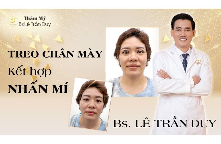 Chương trình chỉnh hình mí mắt bẩm sinh và dị tật mắt miễn phí tại Thẩm mỹ viện Galaxy