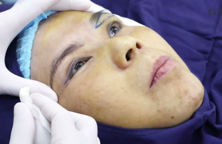 Tiếp sức làm đẹp – miễn phí 100%