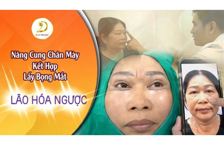 Lựa chọn địa chỉ uy tín, tìm hiểu kỹ tay nghề bác sĩ