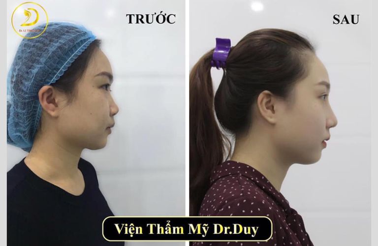 Các bước tham gia chương trình để có cơ hội lột xác miễn phí