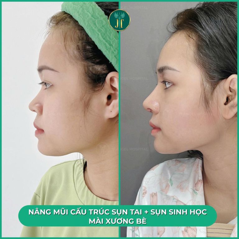 Bệnh viện Thẩm mỹ JT Angel