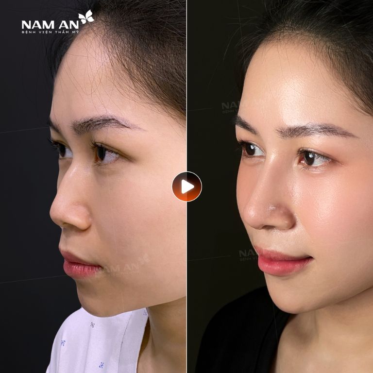 Bệnh viện Thẩm mỹ Nam An