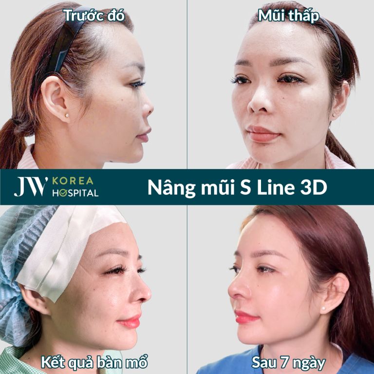 Bệnh viện Thẩm mỹ JW Hàn Quốc