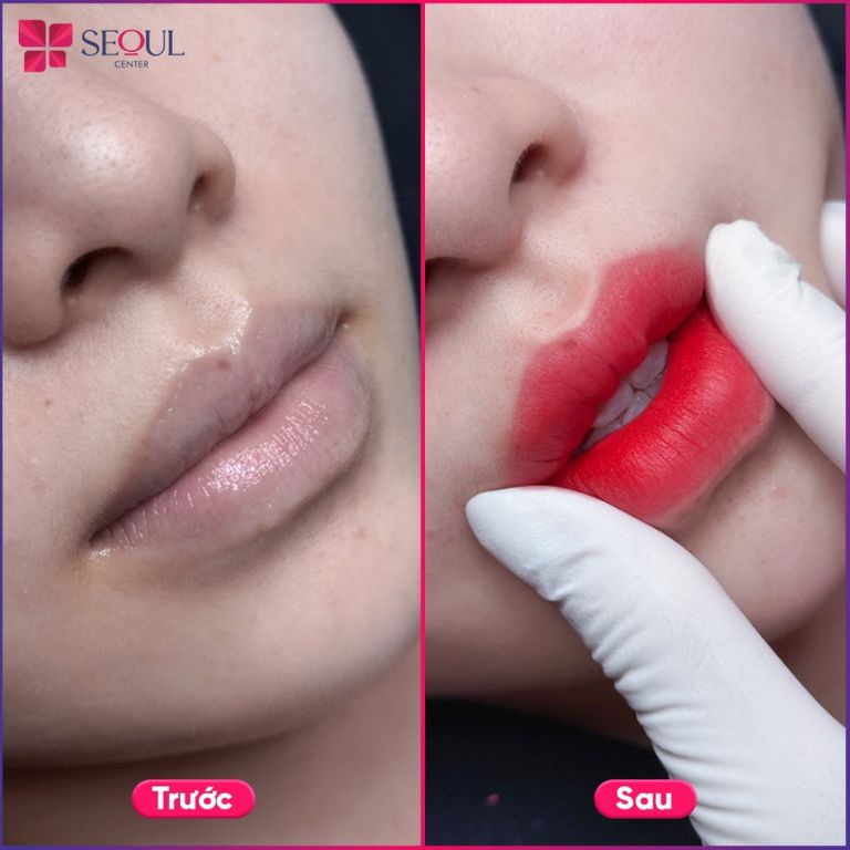 Thẩm mỹ viện Seoul Center