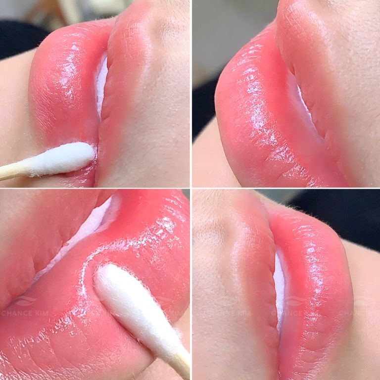 Thẩm mỹ viện Chance Kim