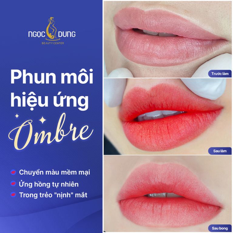 Thẩm mỹ viện Ngọc Dung