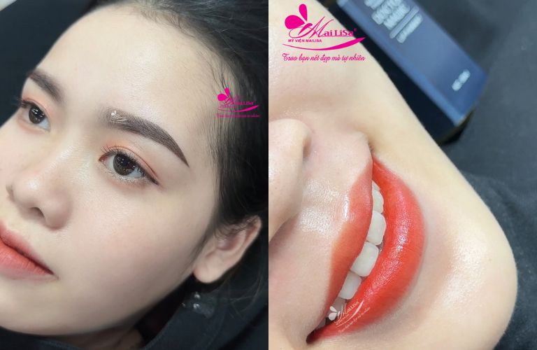 Thẩm mỹ viện Mailisa