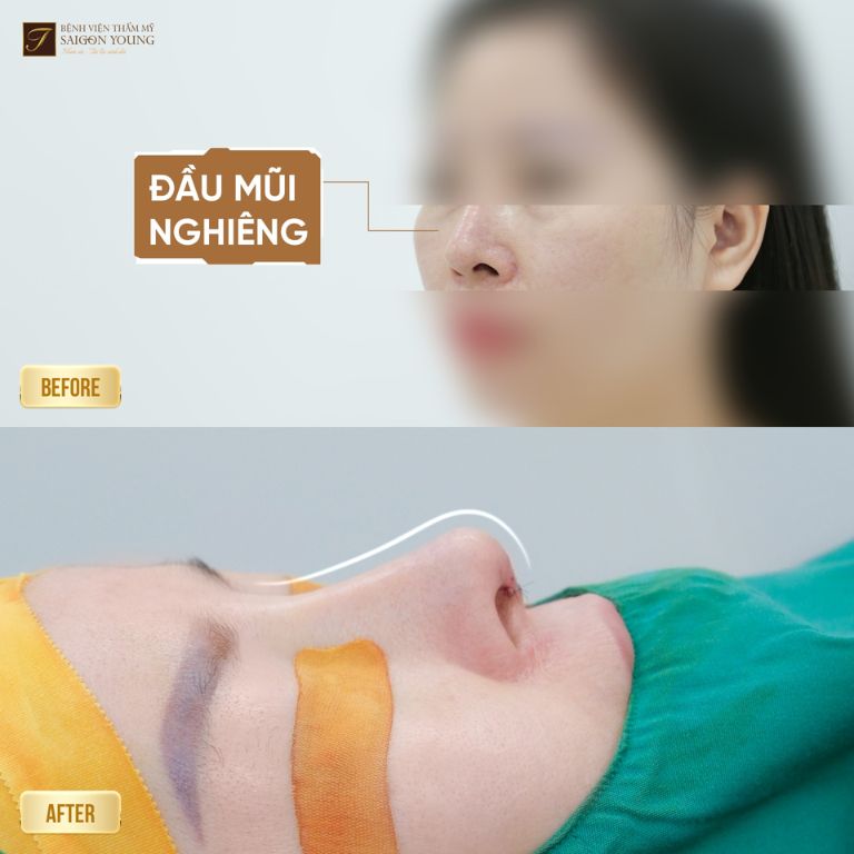 Bệnh Viện Thẩm Mỹ Saigon Young