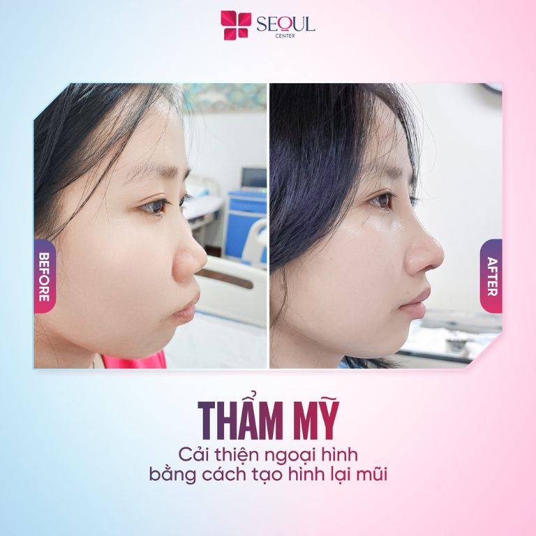 Thẩm Mỹ Viện Seoul Center