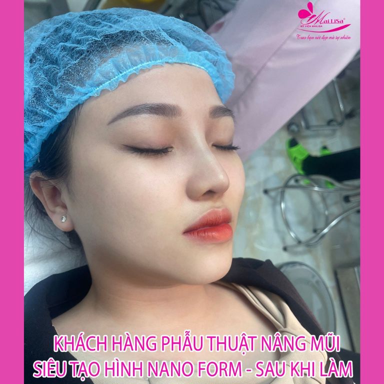 Thẩm mỹ viện Mailisa