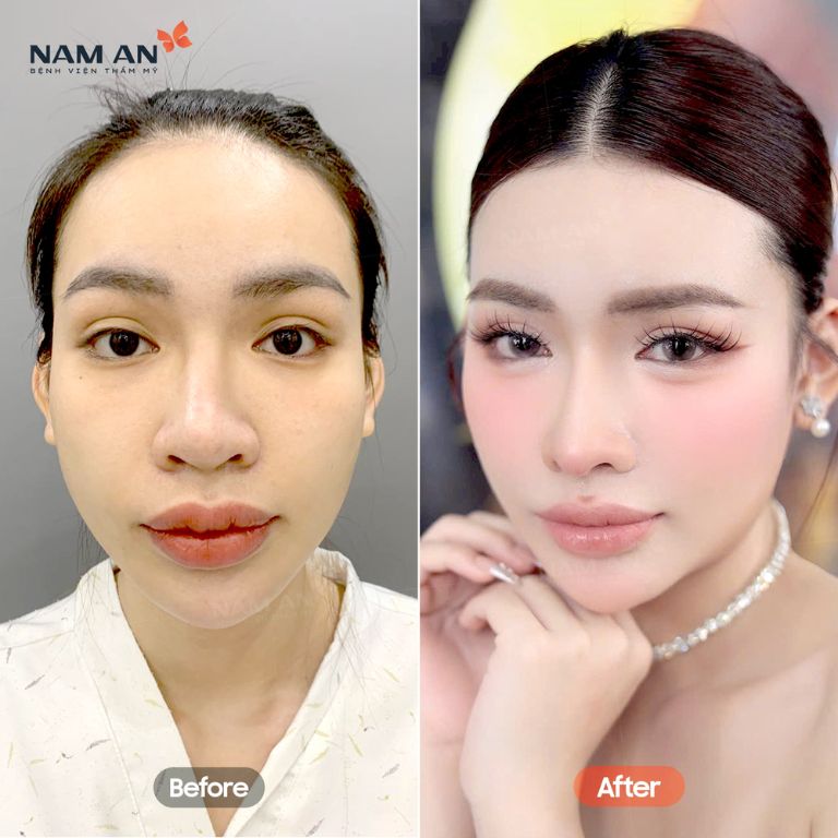 Bệnh viện Thẩm mỹ Nam An