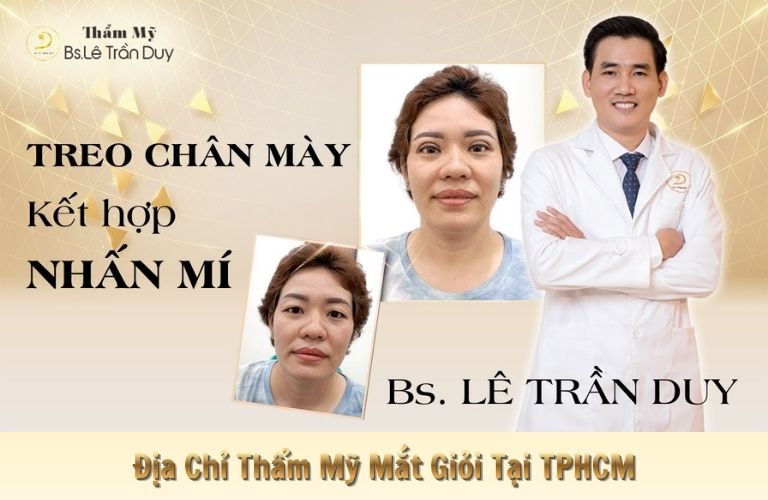 Thẩm mỹ mắt với Chuyên gia - BS Lê Trần Duy tại Thẩm mỹ viện Galaxy