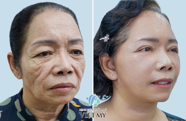 Bệnh Viện Chuyên Khoa Thẩm Mỹ Việt Mỹ