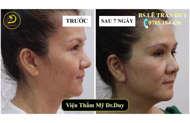 Những ảnh hưởng tích cực sau thẩm mỹ tại Galaxy