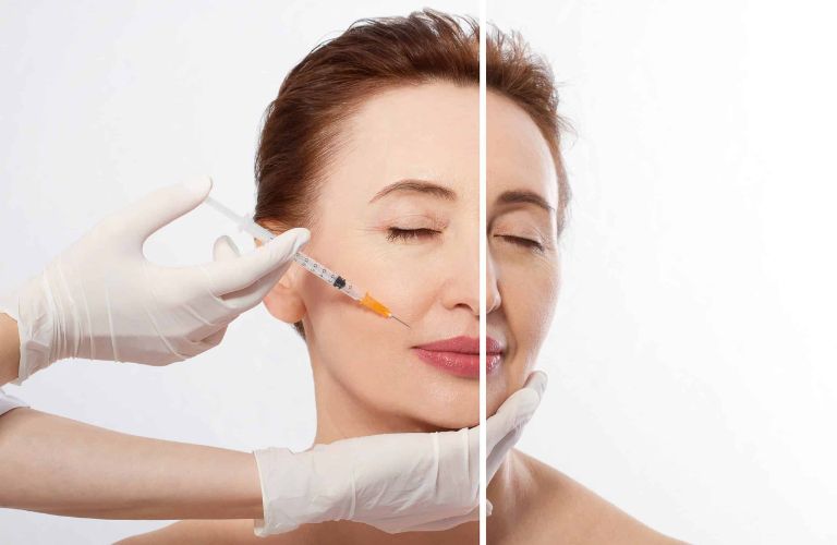 Sử dụng sản phẩm Botox chính hãng, có nguồn gốc rõ ràng