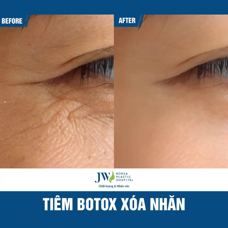 Bệnh viện Thẩm mỹ JW Hàn Quốc