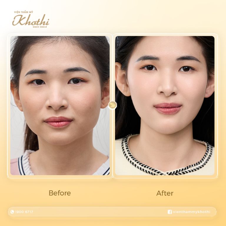 Viện Thẩm mỹ Khơ Thị