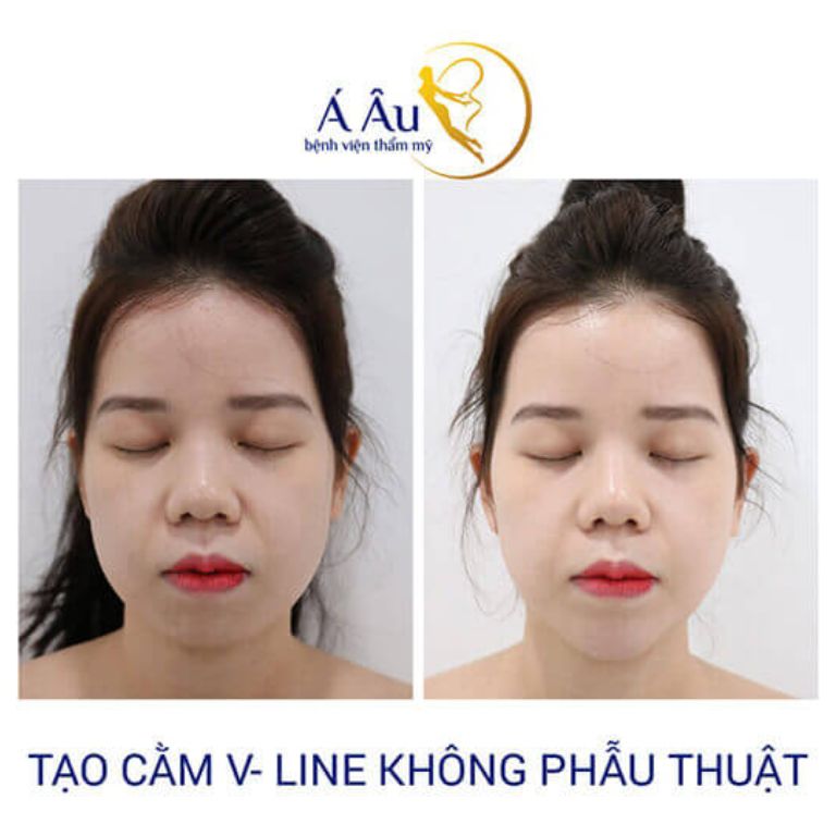 Bệnh viện Thẩm mỹ Á Âu